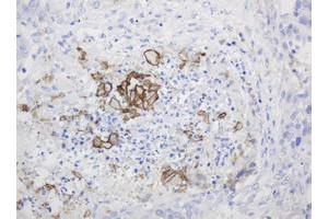 Image no. 1 for anti-Parathyroid Hormone (PTH) (AA 32-115) antibody (ABIN1491410) (PTH 抗体  (AA 32-115))