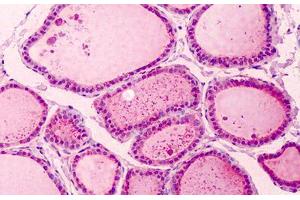 Human Thyroid: Formalin-Fixed, Paraffin-Embedded (FFPE) (PAK2 抗体  (C-Term))