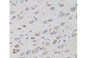 Immunohistochemistry of paraffin-embedded Rat brain using PSMD10 Polyclonal Antibody at dilution of 1:100 (40x lens). (PSMD10 抗体)