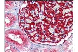 Human Kidney: Formalin-Fixed, Paraffin-Embedded (FFPE) (ENPEP 抗体  (Tyr182))