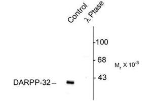 Image no. 1 for anti-Protein Phosphatase 1, Regulatory (Inhibitor) Subunit 1B (PPP1R1B) (pThr75) antibody (ABIN229344)