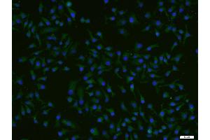 HepG2 cells were stained with ADCK4 Polyclonal Antibody, Unconjugated (bs-8070R) at 1:200 and incubated for 90 minutesat room temperature, followed by secondary antibody incubation, DAPI staining of the nuclei and detection. (ADCK4 抗体  (AA 65-170))