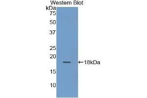 Detection of Recombinant KRT19, Human using Polyclonal Antibody to Cytokeratin 19 (CK19)