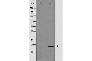 Western blot analysis of extracts of mouse liver, using CAMP antibody. (Cathelicidin 抗体  (Internal Region))