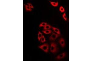 Immunofluorescent analysis of ATG13 staining in A549 cells. (ATG13 抗体)