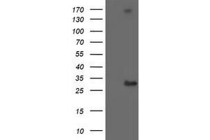 Western Blotting (WB) image for anti-Regulatory Factor X-Associated Ankyrin Containing Protein (RFXANK) antibody (ABIN1500682) (RFXANK 抗体)