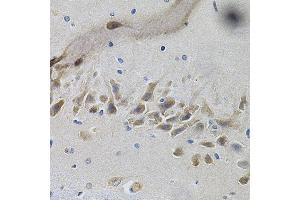 Immunohistochemistry (IHC) image for anti-Neurotrophic Tyrosine Kinase, Receptor, Type 1 (NTRK1) (C-Term) antibody (ABIN7268895)