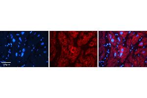 Rabbit Anti-AK1 Antibody   Formalin Fixed Paraffin Embedded Tissue: Human heart Tissue Observed Staining: Cytoplasmic Primary Antibody Concentration: N/A Other Working Concentrations: 1:600 Secondary Antibody: Donkey anti-Rabbit-Cy3 Secondary Antibody Concentration: 1:200 Magnification: 20X Exposure Time: 0. (Adenylate Kinase 1 抗体  (N-Term))