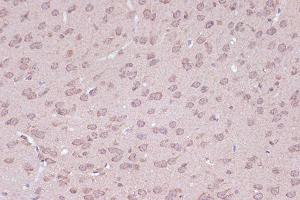 Immunohistochemistry (IHC) image for anti-BCL2-Associated Athanogene 2 (BAG2) antibody (ABIN7265849)