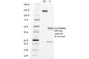 SDS-PAGE Analysis Purified TAG-72 Mouse Monoclonal Antibody (B72. (TAG-72 / CA72.4 抗体)