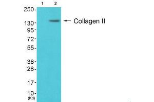 anti-Collagen, Type II (COL2) (N-Term) antibody