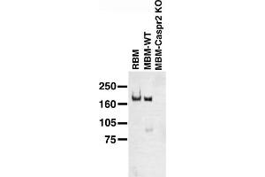 Immunoblot on adult rat brain membrane (RBM), and adult mouse brain membranes (MBM) from wild-type (WT) and Caspr2 knockout mice. (CNTNAP2 抗体  (Extracellular))