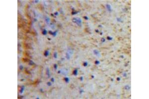 Used in DAB staining on fromalin fixed paraffin-embedded Brain tissue (Peptide YY 抗体  (AA 31-97))