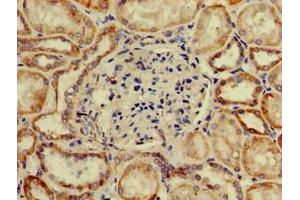 Immunohistochemistry of paraffin-embedded human kidney tissue using ABIN7170416 at dilution of 1:100 (SP11 (AA 137-386) 抗体)