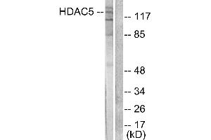 Western blot analysis of extracts from HepG2 cells, treated with PMA (125ng/ml, 30mins), using HDAC5 antibody (#C0225). (HDAC5 抗体)