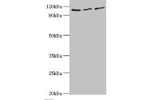 Western blot All lanes: MERTK antibody at 8 μg/mL Lane 1: Mouse gonad tissue Lane 2: Mouse lung tissue Lane 3: Mouse kidney tissue Secondary Goat polyclonal to rabbit IgG at 1/10000 dilution Predicted band size: 110 kDa Observed band size: 110 kDa (MERTK 抗体  (AA 840-999))