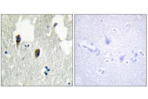 Immunohistochemistry analysis of paraffin-embedded human brain tissue, using KLHL3 antibody. (KLHL3 抗体  (N-Term))