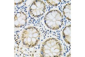 Immunohistochemistry of paraffin-embedded human colon using SNRPE Antibody (ABIN1876676) at dilution of 1:200 (40x lens). (SNRPE 抗体)