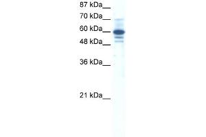 WB Suggested Anti-ZNF276 Antibody Titration:  0. (ZNF276 抗体  (Middle Region))