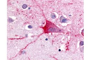Anti-TRH Receptor antibody IHC of human brain, neurons and glia. (TRHR 抗体  (Cytoplasmic Domain))