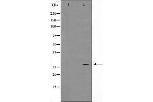 Western blot analysis on MCF7 cell lysate using BCL-2 Antibody，The lane on the left is treated with the antigen-specific peptide. (Bcl-2 抗体  (Internal Region))