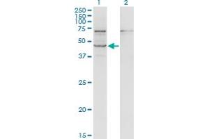 STRADB Antikörper  (AA 319-418)