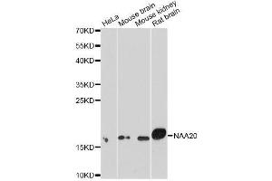 Western blot analysis of extracts of various cell lines, using NAA20 antibody. (NAT5 抗体  (AA 49-178))