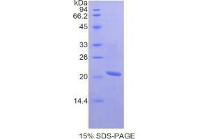 SDS-PAGE (SDS) image for serpin Peptidase Inhibitor, Clade B (Ovalbumin), Member 4 (SERPINB4) protein (ABIN3011738)