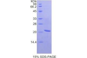 SDS-PAGE analysis of Mouse SCCA2 Protein. (SERPINB4 蛋白)