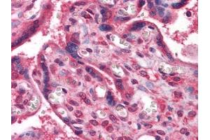 Immunohistochemical analysis of paraffin-embedded human Placenta tissues using anti-NME1 antibody (NME1 抗体)