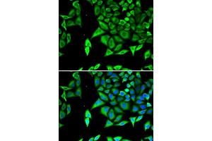 Immunofluorescence analysis of U2OS cells using NPPA antibody. (NPPA 抗体  (AA 26-151))