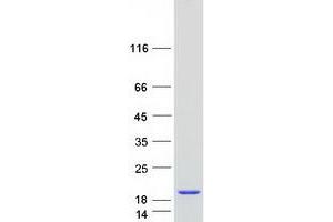Validation with Western Blot