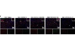Immunofluorescence (Paraffin-embedded Sections) (IF (p)) image for anti-Microtubule-Associated Protein 1 Light Chain 3 beta (MAP1LC3B) antibody (ABIN1385814)