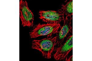 Immunofluorescence (IF) image for anti-SP140 Nuclear Body Protein (SP140) antibody (ABIN2997006) (SP140 抗体)