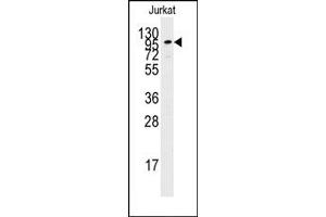 Image no. 1 for anti-Adenylate Cyclase 2 (Brain) (ADCY2) (C-Term) antibody (ABIN357898) (ADCY2 抗体  (C-Term))