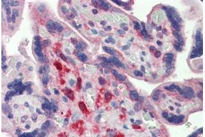 Human Placenta: Formalin-Fixed, Paraffin-Embedded (FFPE) (YES1 抗体  (AA 284-541))