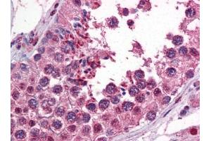 Immunohistochemistry (IHC) image for anti-Calcium/calmodulin-Dependent Protein Kinase II beta (CAMK2B) (AA 1-504) antibody (ABIN614553) (CAMK2B 抗体  (AA 1-504))