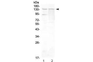 Western blot testing of rat 1) testis and 2) PC-12 lysate with RTEL1 antibody at 0. (RTEL1 抗体)