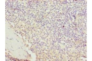 Immunohistochemistry of paraffin-embedded human spleen tissue using ABIN7170488 at dilution of 1:100 (STPG2 抗体  (AA 201-459))