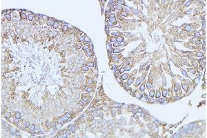 ABIN6279134 at 1/100 staining Mouse testis tissue by IHC-P. (BCL2L14 抗体  (N-Term))