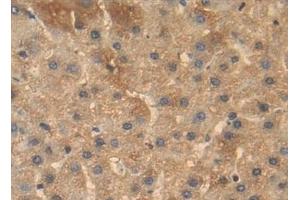 Detection of BMP4 in Human Liver Tissue using Polyclonal Antibody to Bone Morphogenetic Protein 4 (BMP4) (BMP4 抗体  (AA 22-408))