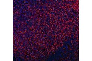 IF analysis of MRC1 using anti-MRC1 antibody (ABIN7600593).