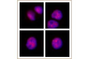MOF / MYST1 antibody (pAb) tested by Immunofluorescence. (MYST1 抗体  (N-Term))