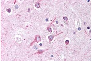Human Brain, Cortex (formalin-fixed, paraffin-embedded) stained with AFF1 antibody ABIN214636 at 10 ug/ml followed by biotinylated goat anti-rabbit IgG secondary antibody ABIN481713, alkaline phosphatase-streptavidin and chromogen. (AF4 抗体  (AA 1190-1203))