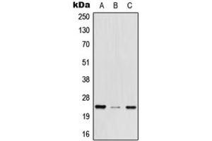 Western blot analysis of MED29 expression in HEK293T (A), mouse brain (B), rat lung (C) whole cell lysates. (MED29 抗体  (Center))