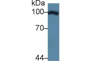 Western blot analysis of Human HeLa cell lysate, using Cow TNPO1 Antibody (5 µg/ml) and HRP-conjugated Goat Anti-Rabbit antibody (