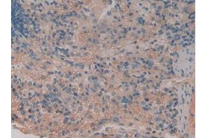 Immunohistochemistry (IHC) image for anti-Tumor Necrosis Factor Receptor Superfamily, Member 1B (TNFRSF1B) (AA 25-229) antibody (ABIN1871703)