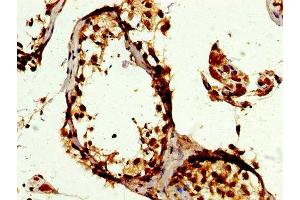 IHC image of ABIN7150235 diluted at 1:300 and staining in paraffin-embedded human testis tissue performed on a Leica BondTM system.