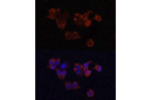 Immunofluorescence (IF) image for anti-Lysosomal-Associated Membrane Protein 1 (LAMP1) (AA 80-280) antibody (ABIN3016286)
