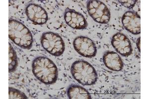 Immunoperoxidase of monoclonal antibody to TYK2 on formalin-fixed paraffin-embedded human colon. (TYK2 抗体  (AA 276-375))